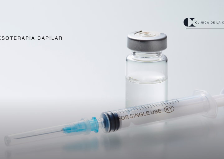 mesoterapia-capilar